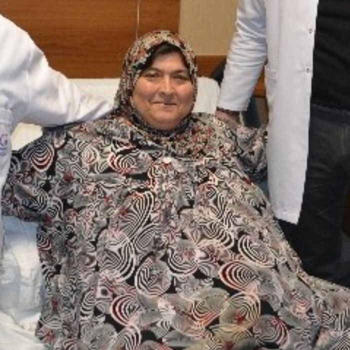 Gaziantep’te Obezite Hastası İle İlgili Başarılı Ameliyat